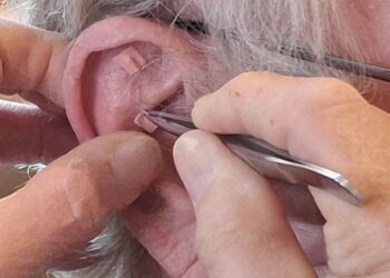 Übergewicht und Adipositas: Ein Blick durch die Linse der Traditionellen Chinesischen Medizin