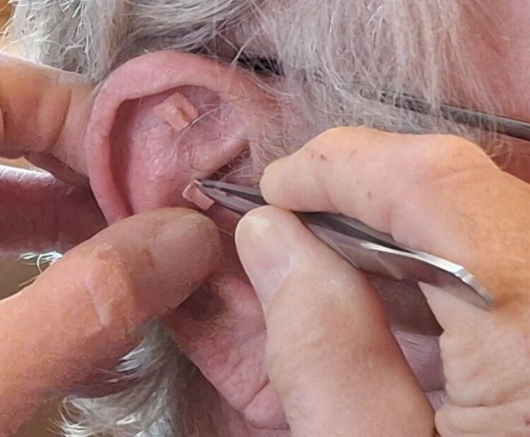 Übergewicht und Adipositas: Ein Blick durch die Linse der Traditionellen Chinesischen Medizin