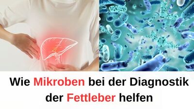 Wie Mikroben bei der Diagnostik der Fettleber helfen